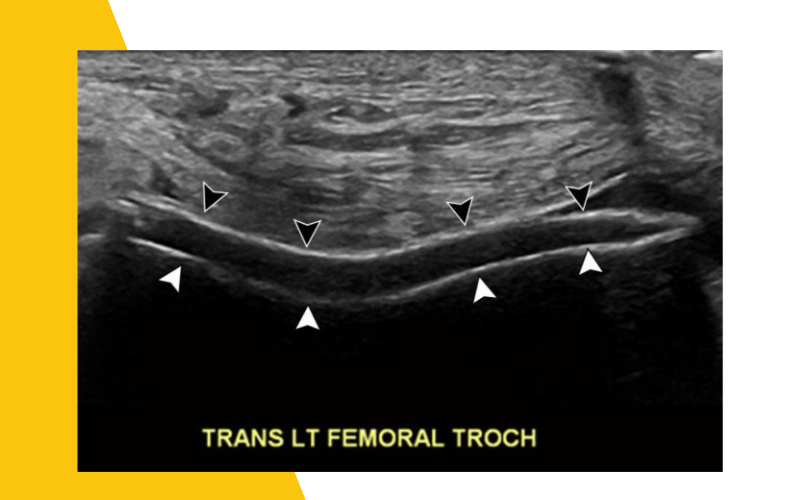 3. Evaluacion rodilla ecografia.png